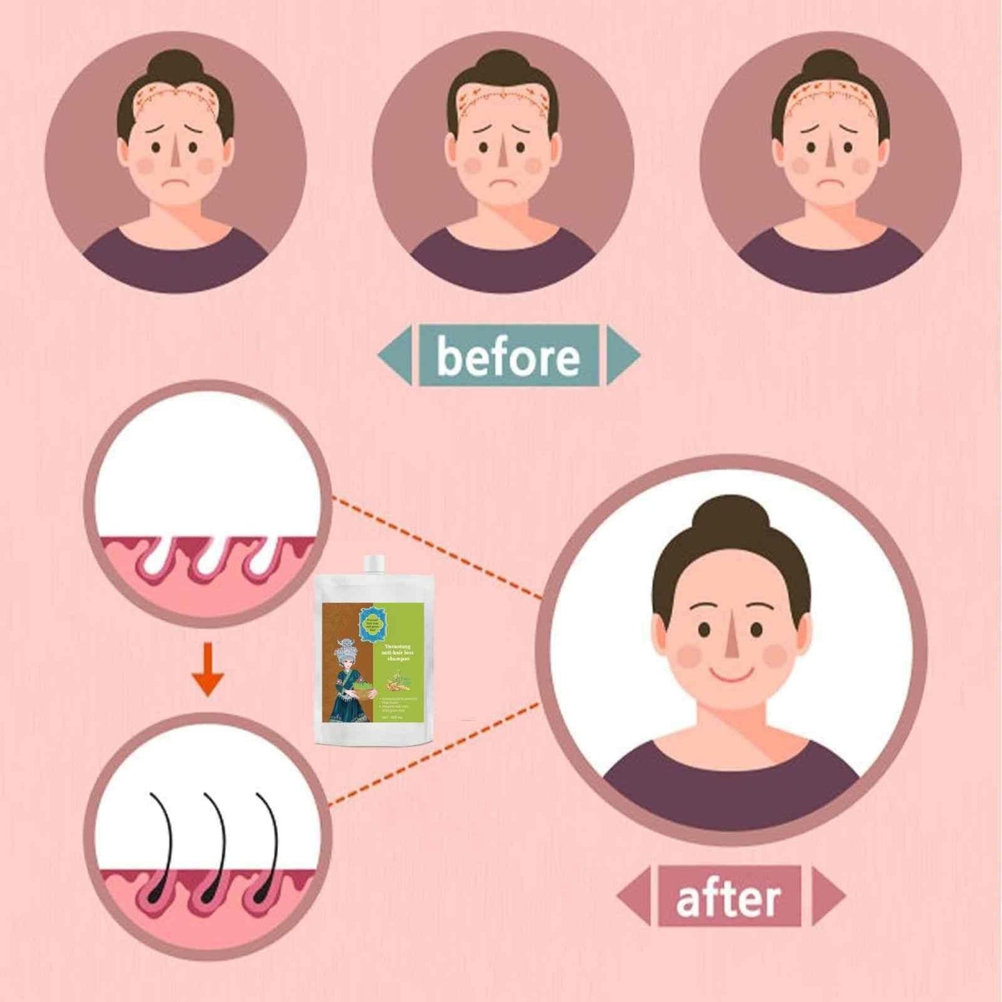 Anti-Hair Loss Hair Shampoo 120ML - NG Fiora